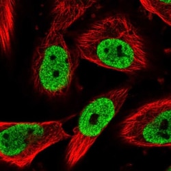 NUP88 Antibody, Novus Biologicals:Antibodies:Primary Antibodies